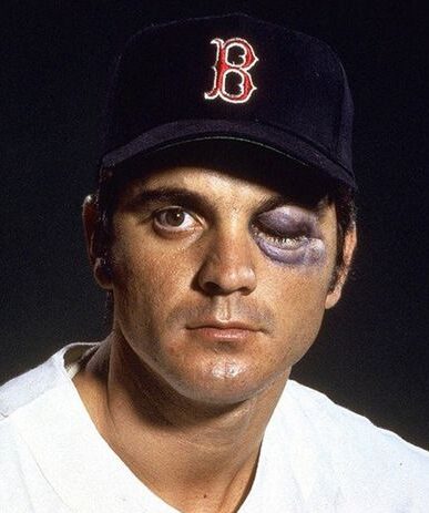 Tony Conigliaro - Cooperstown Expert